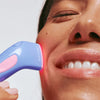 Valoterapia & aknehoitolaite DermaClear